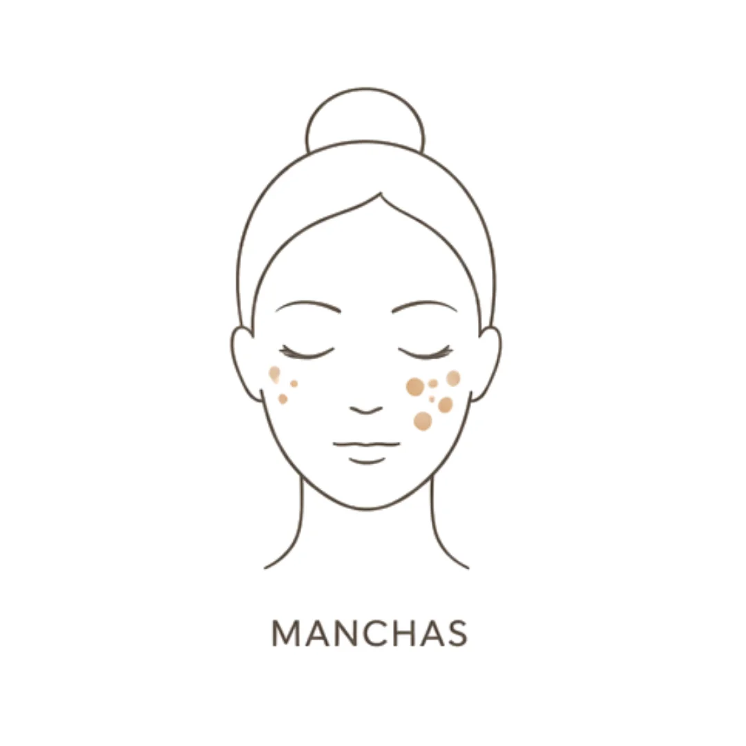 Manchas