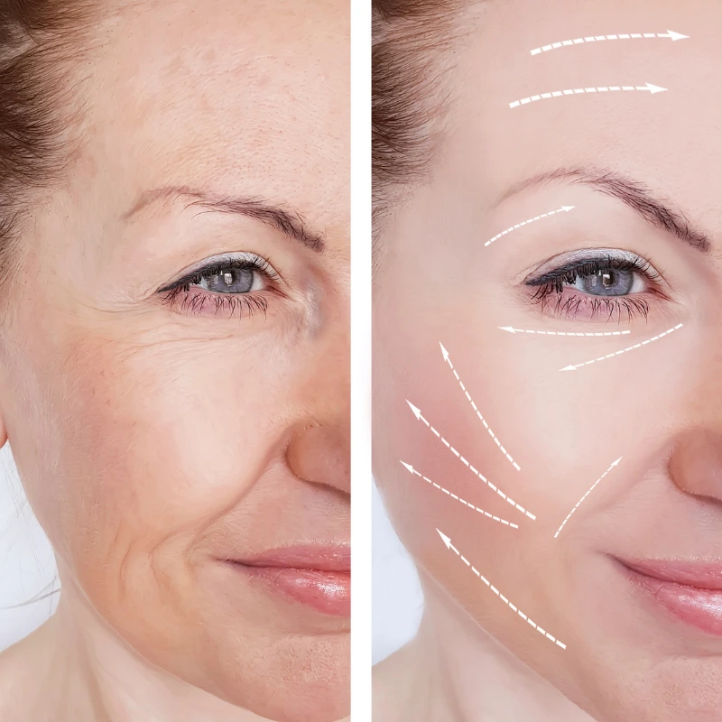 Mujer aplicando serum con gotero como parte de su rutina skincare antiedad