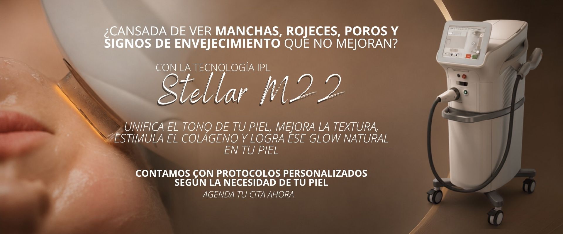 Stellar M22 Barranquilla