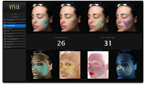 Detalle de análisis de piel